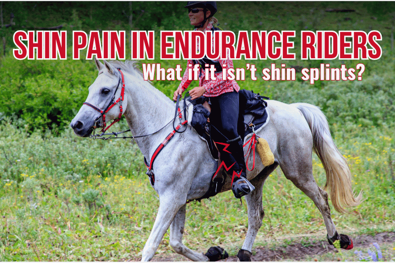 Shin Pain in Equestrian Endurance Riders